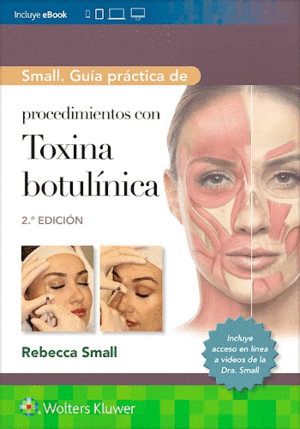 SMALL. GUÍA PRÁCTICA DE PROCEDIMIENTOS CON TOXINA BOTULÍNICA. 2ª ED.