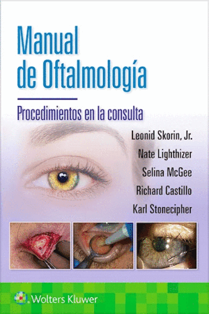 MANUAL DE OFTALMOLOGÍA