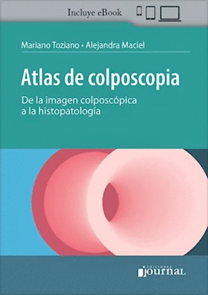 ATLAS DE COLPOSCOPIA. DE LA IMAGEN COLPOSCÓPICA A LA HISTOPATOLOGÍA